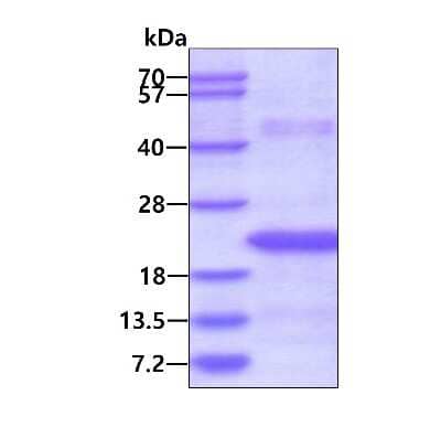 SDS-Page: Recombinant Human MED21 His Protein [NBP2-23221] - 3ug by SDS-PAGE under reducing condition and visualized by coomassie blue stain.